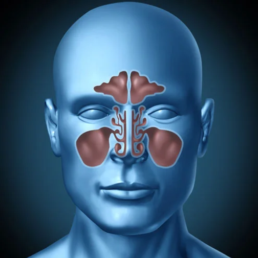 Anatomie des sinus enflammés